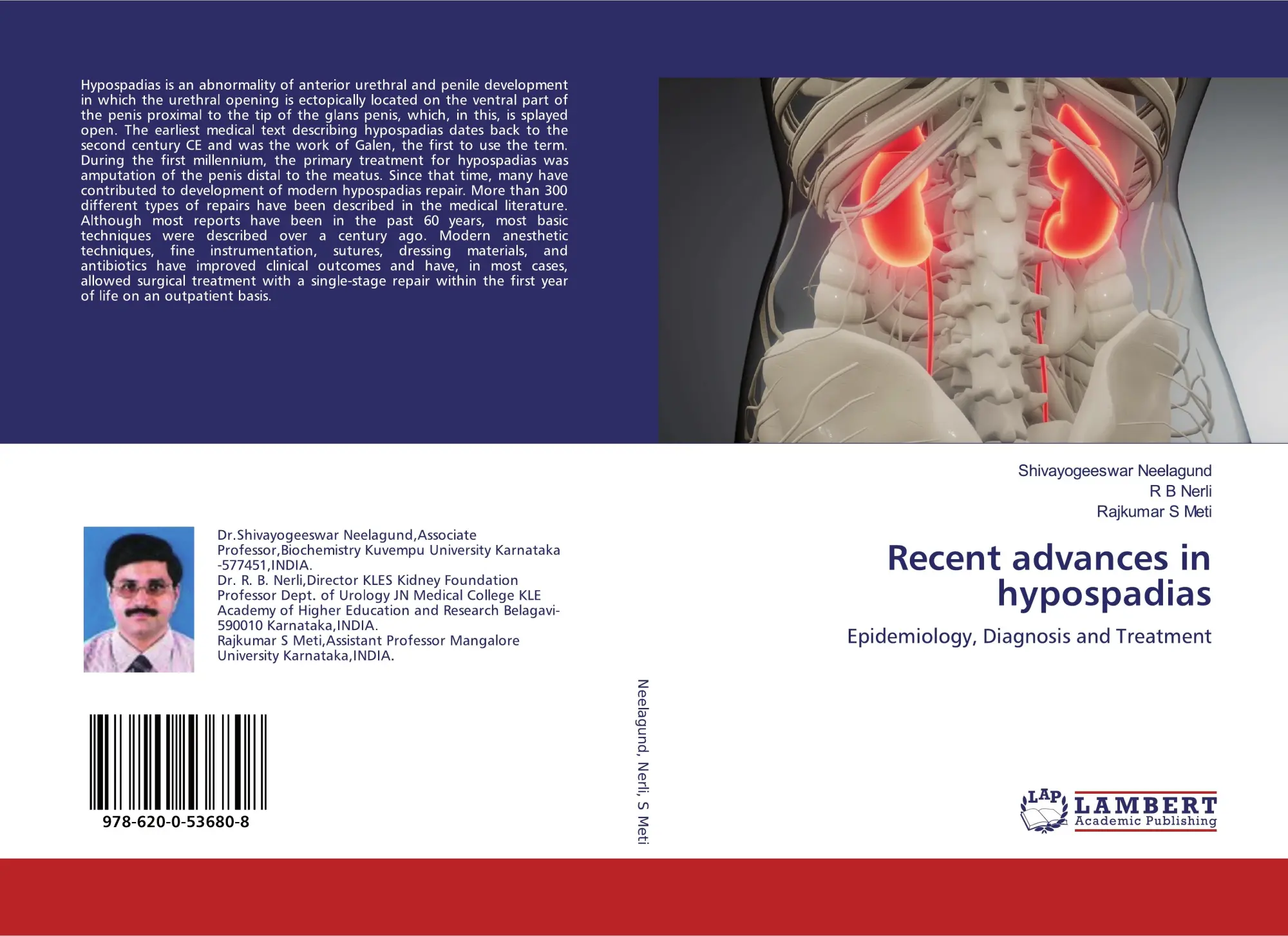 Shivayogeeswar Neelagund (U. A.) | Recent Advances In Hypospadias | Taschenbuch-image