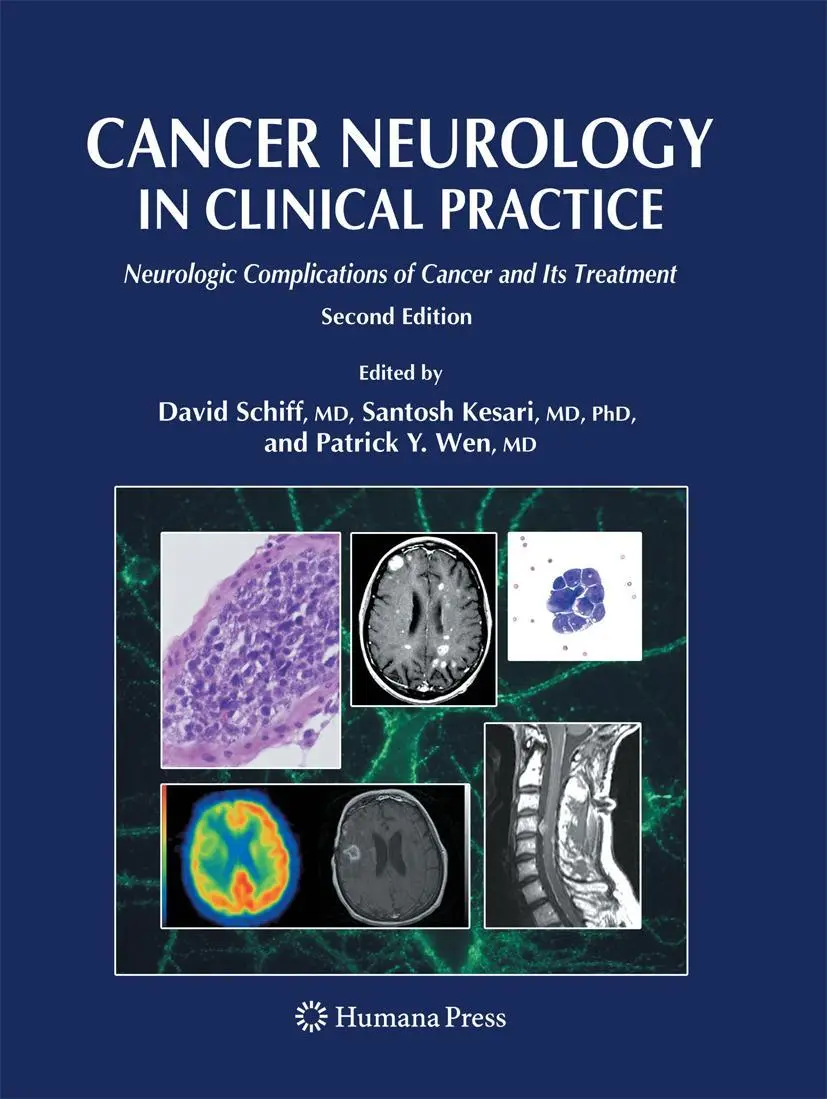 David Schiff (U. A.) | Cancer Neurology In Clinical Practice | Taschenbuch | Xvi-image
