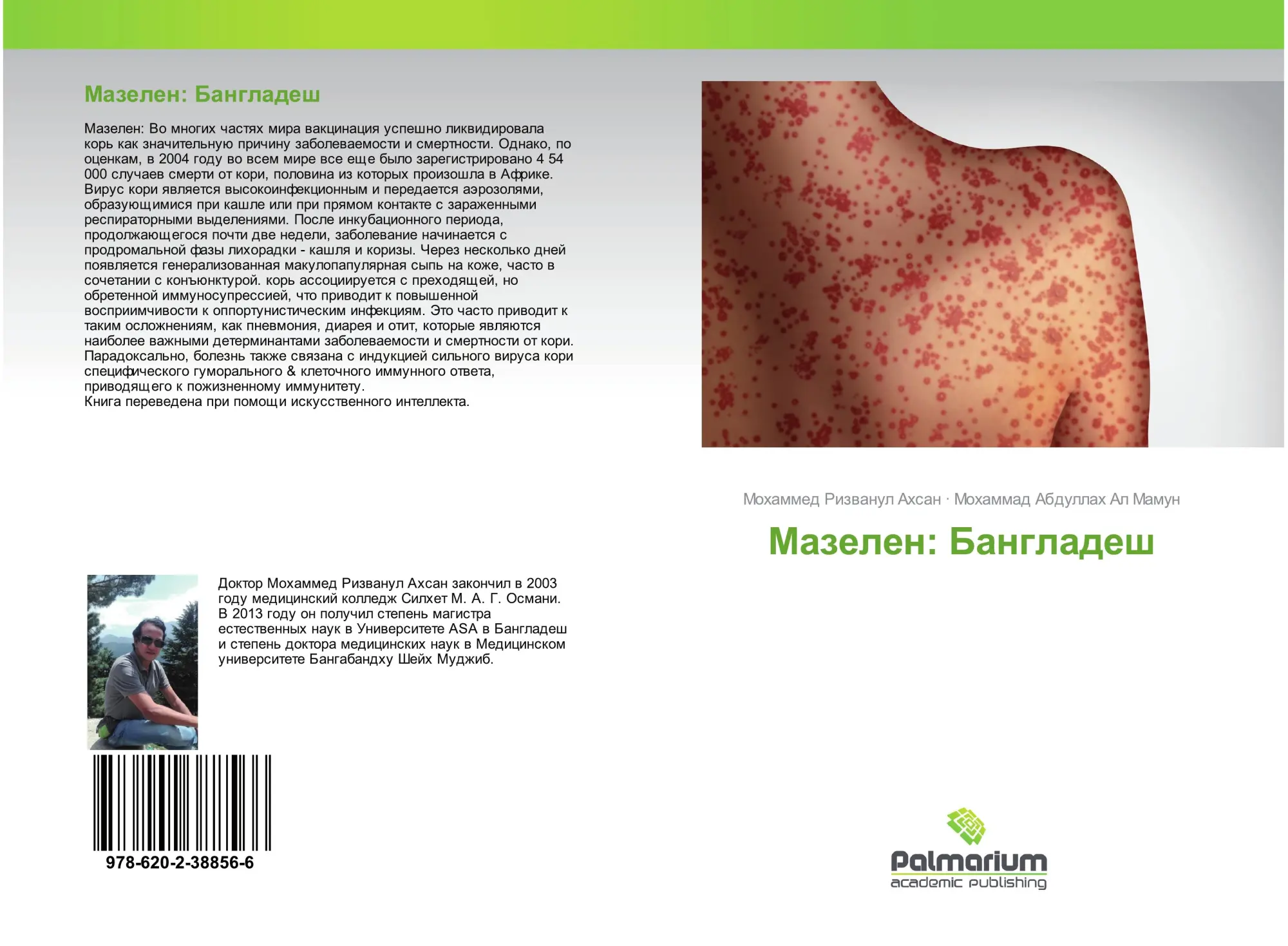 Mohammed Rizwanul Ahsan (U. A.) | Mazelen: Bangladesh | Taschenbuch | Russisch-image