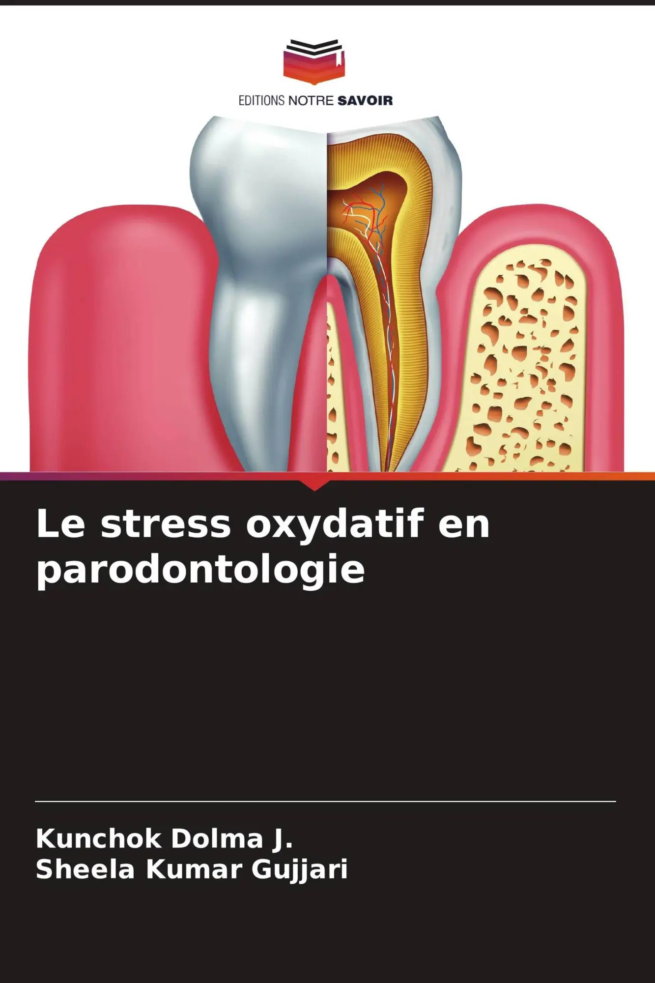Kunchok Dolma J. (U. A.) | Le Stress Oxydatif En Parodontologie | Taschenbuch-image